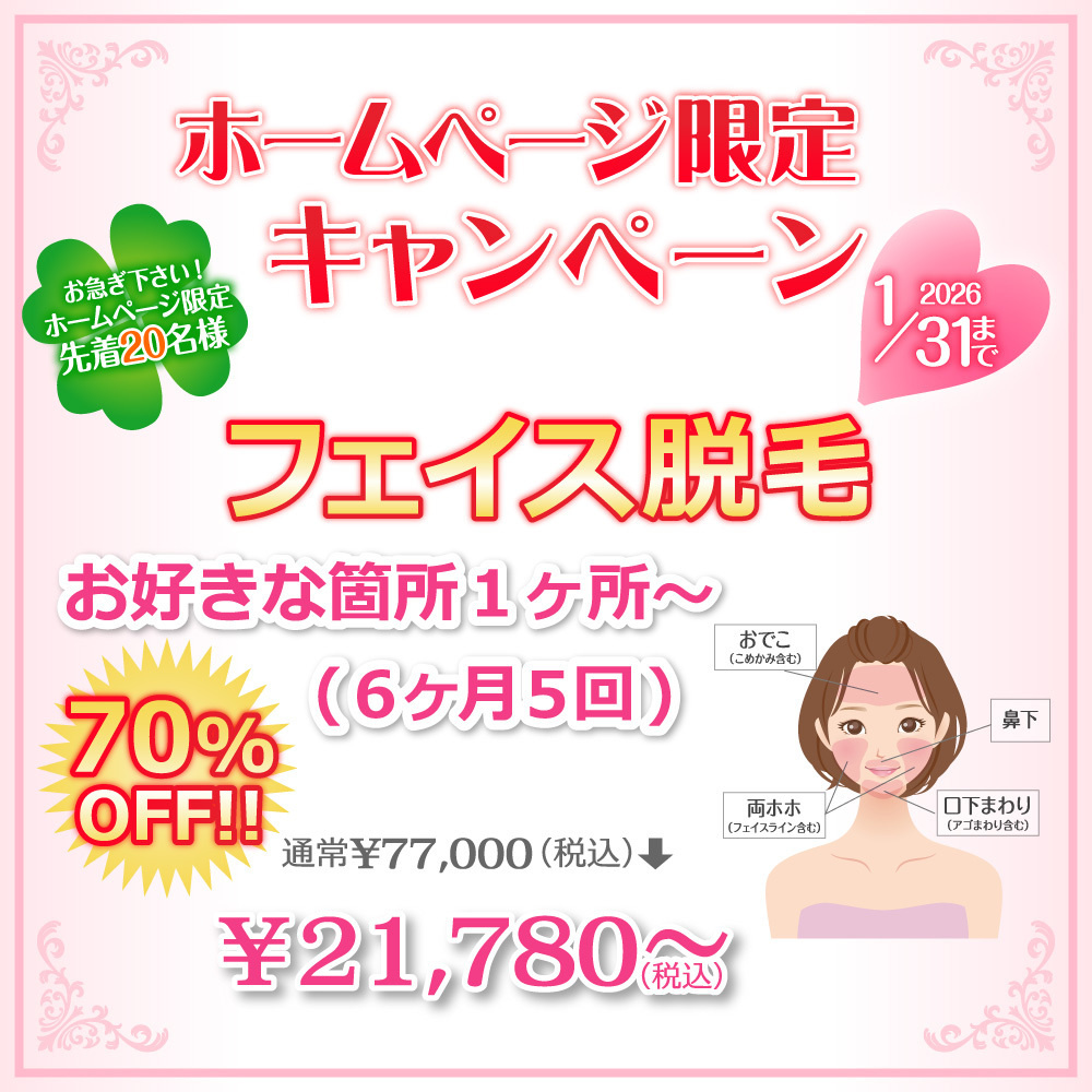 ホームページ限定キャンペーン！お急ぎください！ホームページ限定先着20名様！フェイス脱毛お好きな1箇所～（6ヶ月5回）通常￥77,000(税込)が70%OFFで!!￥21,780～(税込)2026年1月31日まで