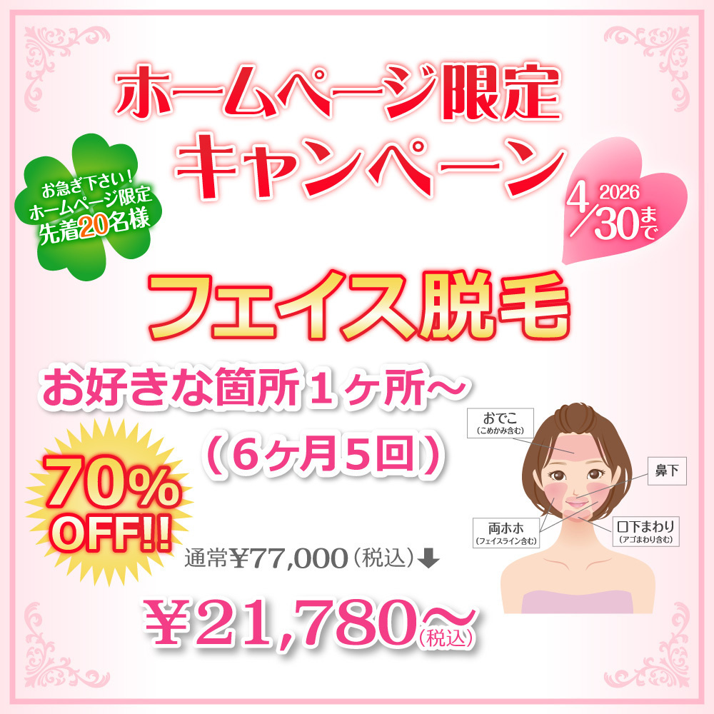 ホームページ限定キャンペーン！お急ぎください！ホームページ限定先着20名様！フェイス脱毛お好きな1箇所～（6ヶ月5回）通常￥77,000(税込)が70%OFFで!!￥21,780～(税込)2026年4月30日まで